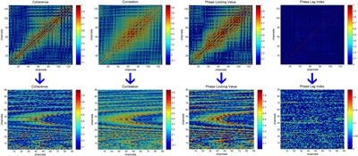 A Deep Learning Approach for Mild Depression Recognition Based on Functional Connectivity Using Electroencephalography